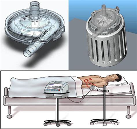 centrifugal blood pump|centrimag lvad support.